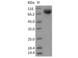 Recombinant Human IL2RG/CD132 Protein (aa 1-254, Fc Tag)