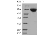 Recombinant Human BMPR2 Protein (His & Fc Tag)(Active)