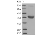 Recombinant Human ACP5/TRAP Protein (His Tag)