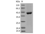 Recombinant Human ACY1/Aminoacylase-1 Protein (His Tag)