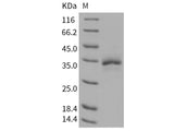 Recombinant Human TFPI2 Protein (His Tag)(Active)