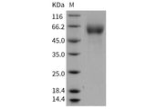 Recombinant Human FGFR4/CD334 Protein (His Tag)(Active)