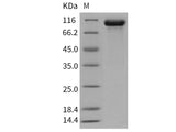 Recombinant Human FGFR4/CD334 Protein (Fc Tag)(Active)