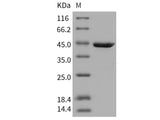 Recombinant Human RAC1/MIG5 Protein (GST Tag)