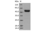 Recombinant Human MMP1 Protein (His Tag)(Active)