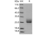 Recombinant Human RELT/TNFRSF19L Protein (His Tag)