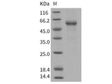 Recombinant Human RELT/TNFRSF19L Protein (His & Fc Tag)