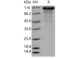 Recombinant Human Kininogen 1/KNG1 Protein (His Tag)(Active)