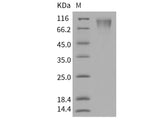 Recombinant Human CD208/LAMP3/DC-LAMP Protein (His Tag)