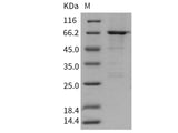 Recombinant Human ATL1/SPG3A/Atlastin-1 Protein (GST Tag)