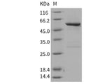 Recombinant Human SPG21 Protein (GST Tag)