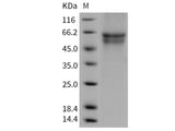 Recombinant Human IL3RA/CD123 Protein (His Tag)(Active)