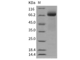 Recombinant Human ADAM15 Protein (CHO Stable Cells, His Tag)