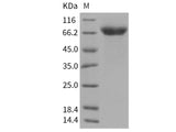 Recombinant Human ADAM15 Protein (HEK293 Cells, His Tag)