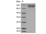 Recombinant Human PDGFRB/CD140b Protein (His Tag)(Active)