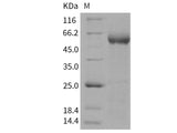 Recombinant Human Contactin 5/CNTN5 Protein (His Tag)(Active)