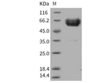 Recombinant Human TREM1 Protein (His & Fc Tag)