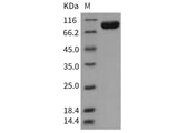 Recombinant Human Tie1 Protein (His Tag)