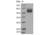 Recombinant Human IL17RD Protein (His Tag)