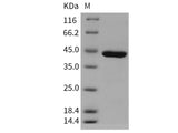 Recombinant Human Carboxypeptidase A1/CPA1 Protein (His Tag)(Active)