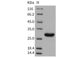 Recombinant Human Carbonic Anhydrase 3/CA3 Protein (His Tag)(Active)