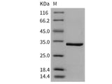 Recombinant Human CA5A/CA-VA Protein (His Tag)(Active)