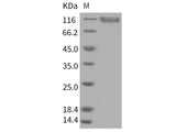 Recombinant Human PSGL-1/CD162 Protein (His & Fc Tag)