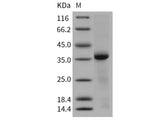 Recombinant Human Cathepsin L/CTSL Protein (His Tag)(Active)