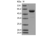 Recombinant Human Cathepsin C/CTSC/DPPI Protein (His Tag)(Active)