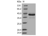 Recombinant Human Cathepsin B/CTSB Protein (His Tag)(Active)