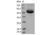 Recombinant Human Cathepsin A/CTSA Protein (His Tag)