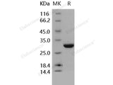 Recombinant Human Carbonic Anhydrase II/CA2 Protein (His Tag)(Active)