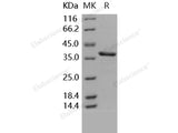 Recombinant Human Carbonic Anhydrase 8/CA8 Protein (His Tag)(Active)