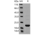 Recombinant Human BID Protein (Active)