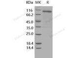 Recombinant Human Nogo Receptor/NgR Protein (His & Fc Tag)(Active)