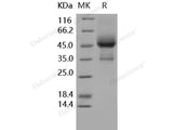 Recombinant Human TGFBR1/ALK-5 Protein (His & Fc Tag)(Active)