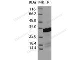 Recombinant Human BCL2L1/Bcl-XL Protein (His Tag)(Active)