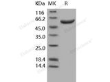 Recombinant Human Arylsulfatase A/ARSA Protein (His Tag)(Active)