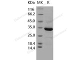 Recombinant Human ANXA5/Annexin Ⅴ/Annexin A5 Protein