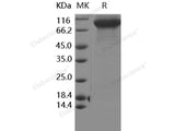 Recombinant Human FLT-3/FLK-2 Protein (His Tag)(Active)