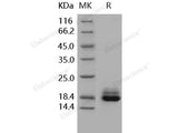 Recombinant Human Cystatin C/CST3 Protein (His Tag)(Active)