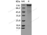 Recombinant Human VE-Cadherin/CDH5 Protein (His & Fc Tag)(Active)