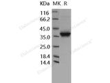 Recombinant Human FN14/TWEAKR Protein (Fc Tag)(Active)