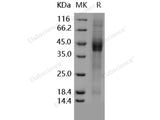 Recombinant Human IGFBP3/IBP3 Protein (His Tag)(Active)