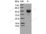 Recombinant Human TROP2/TACSTD2 Protein (aa 1-274, His Tag)