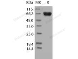 Recombinant Human TROP2/TACSTD2 Protein (His & Fc Tag)(Active)