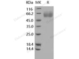 Recombinant Human MSR1/SCARA1/CD204 Protein (His Tag)