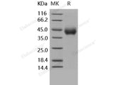 Recombinant Human TNFRSF1B/CD120b Protein (His Tag)(Active)