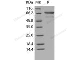 Recombinant Human TNFRSF1B/CD120b Protein (His & Fc Tag)(Active)