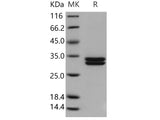 Recombinant Human Kallikrein 7/KLK7 Protein (His Tag)(Active)